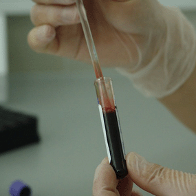 Curso Técnico en inmunología y bioquímica